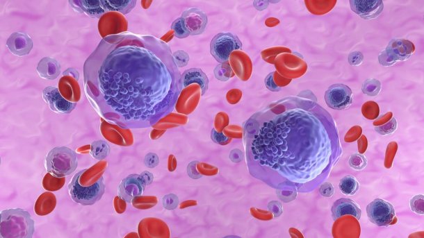 Diego Kaen: "La leucemia es un cáncer o la enfermedad no controlada de la médula ósea"
