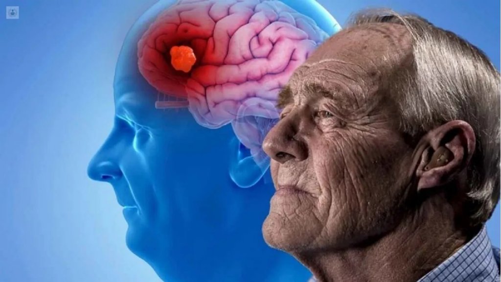 Dr. Carlos Mangone: "Se calcula que Argentina hay alrededor de 400 mil pacientes sufriendo Alzheimer"