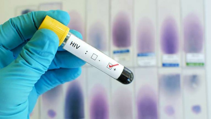 Una mujer argentina logró controlar la infección por VIH sin necesidad de tratamiento