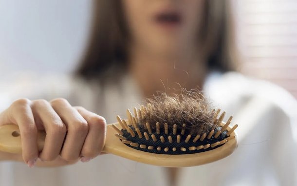 Dra. Estefanía Romera: "La caída del cabello en las mujeres es mucho más frecuente que en los hombres, pero ellas suelen acudir más rápido a la consulta"